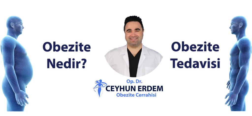 Obezite Nedir?