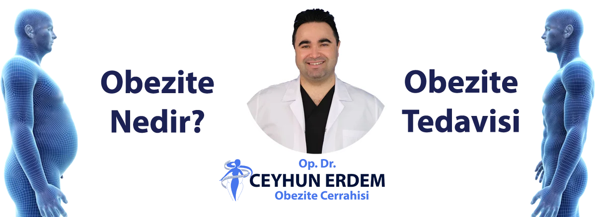 obezite nedir, obezite tedavisi, obezitenin nedenleri, obezite cerrahisi