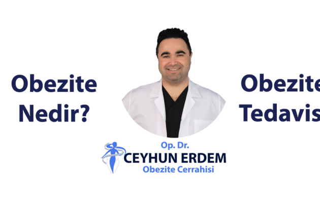 obezite nedir, obezite tedavisi, obezitenin nedenleri, obezite cerrahisi