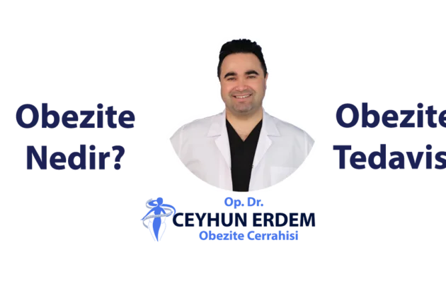 obezite nedir, obezite tedavisi, obezitenin nedenleri, obezite cerrahisi