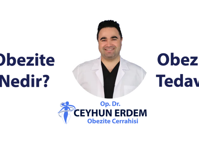 obezite nedir, obezite tedavisi, obezitenin nedenleri, obezite cerrahisi