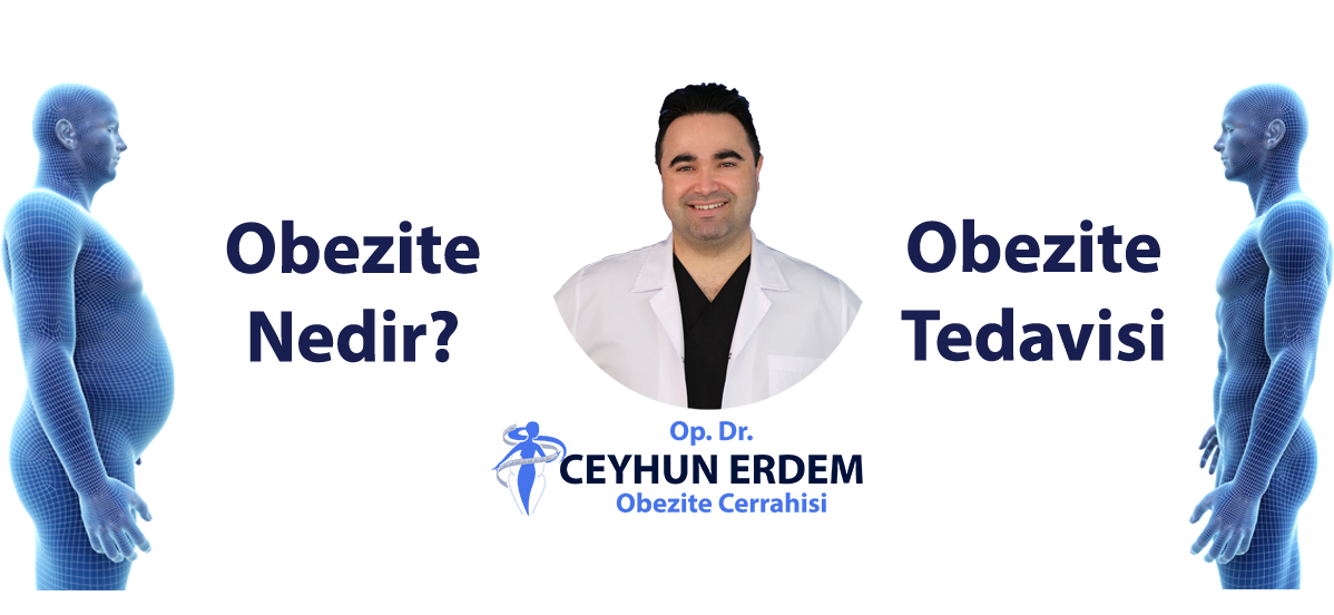 Obezite Nedir?