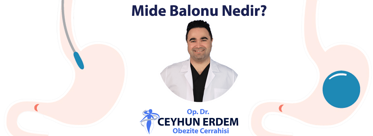 Mide balonu, Mide balonu nedir, Mide balonu ekşi, Mide balonu fiyatları, Mide balonu ne kadar