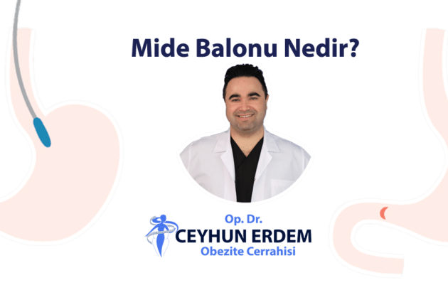 Mide balonu, Mide balonu nedir, Mide balonu ekşi, Mide balonu fiyatları, Mide balonu ne kadar