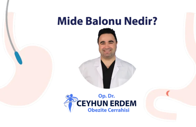 Mide balonu, Mide balonu nedir, Mide balonu ekşi, Mide balonu fiyatları, Mide balonu ne kadar