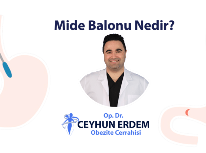 Mide balonu, Mide balonu nedir, Mide balonu ekşi, Mide balonu fiyatları, Mide balonu ne kadar