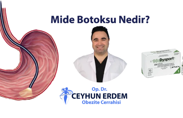 Mide botoksu, Mide botoksu nedir, Mide botoksu fiyat, Mide botoksu sonrası beslenme, Mide botoksu yaptıranlar, Mide botoksu nasıl yapılır