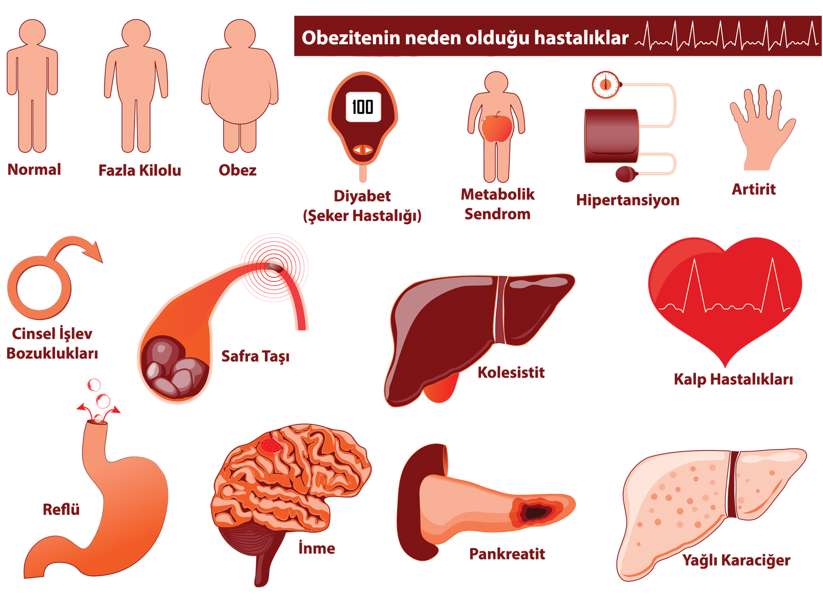 Obezitenin neden olduğu hastalıklar, obezite nedir, obezite tedavisi, obezitenin nedenleri, obezite cerrahisi